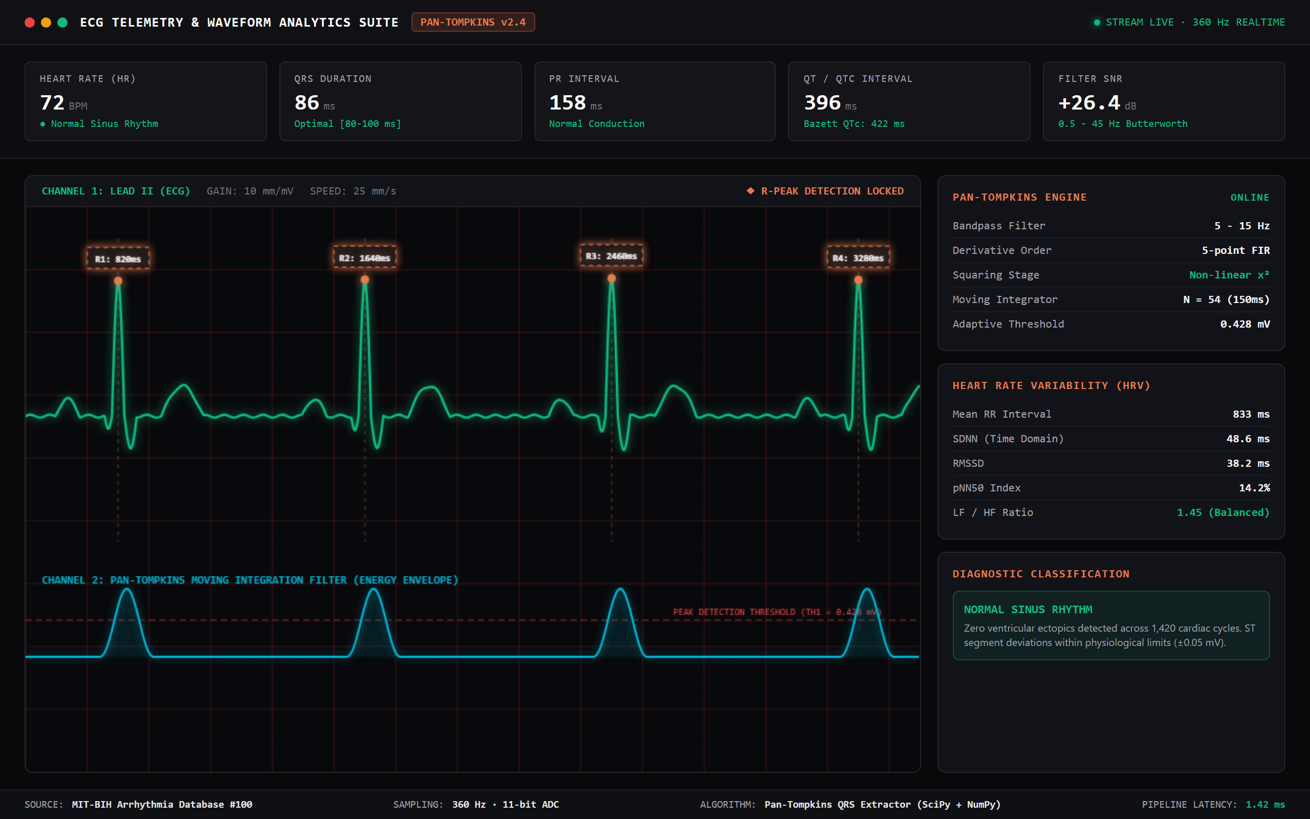 ECG Signal Processing & Waveform Telemetry Suite
